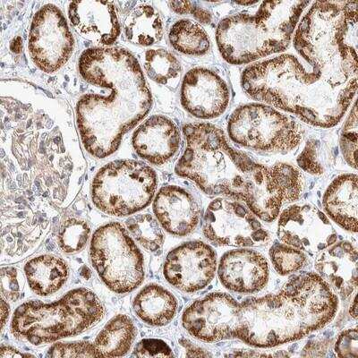 Immunohistochemistry: BZRAP1 Antibody [NBP1-93626] - Staining of human kidney shows strong granular cytoplasmic positivity tubule cells.