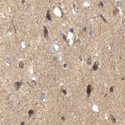 Immunohistochemistry-Paraffin BZRAP1 Antibody - BSA Free