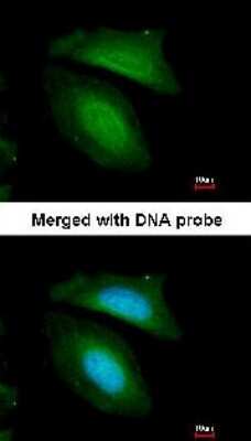 Immunocytochemistry/ Immunofluorescence BZW2 Antibody - BSA Free