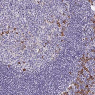 Immunohistochemistry: Bad Antibody [NBP2-38947] - Staining of human tonsil shows strong cytoplasmic positivity in subset of cells in germinal and non-germinal center cells.