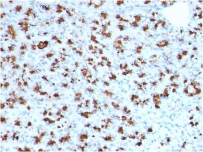 Immunohistochemistry-Paraffin: BarX1 Antibody (BARX1/2760) - Azide and BSA Free [NBP3-08671] - Formalin-fixed, paraffin-embedded human Pancreas stained with BarX1 Mouse Monoclonal Antibody (BarX1/2760).