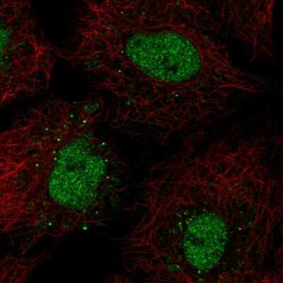 Immunocytochemistry/Immunofluorescence: BarX1 Antibody [NBP2-58378] - Staining of human cell line A549 shows localization to nucleoplasm & vesicles.
