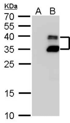 Western Blot: BarX1 Antibody [NBP2-43736] - Analysis of A. 30 ug 293T whole cell lysate/extract B. 30 ug whole cell lysate/extract of human BARX1-transfected 293T cells 12 % SDS-PAGE BARX1 antibody dilution: 1:20000.