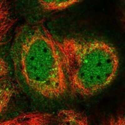 Immunocytochemistry/ Immunofluorescence BarX2 Antibody - BSA Free