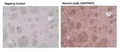 Immunohistochemistry-Paraffin: Bassoon Antibody (SAP7F407) [NBP2-89079] - Immunohistochemistry analysis of formalin-fixed, paraffin-embedded rat brain tissue stained with Bassoon monoclonal antibody (SAP7F407) at 10ug/ml.