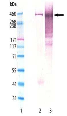 Western Blot: Bassoon Antibody (SAP7F407) [NBP2-89079] - Western Blot analysis of NBP2-89079: Lane 1: NovexTM HiMarkTM MW Marker, Lane 2: Mouse Brain lysate, Lane 3: Rat Brain lysate