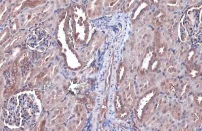 <b>Orthogonal Strategies Validation. </b>Immunohistochemistry-Paraffin: Bax Antibody (HL236) [NBP3-13676] - Bax antibody [HL236] detects Bax protein at cytoplasm by immunohistochemical analysis. Sample: Paraffin-embedded mouse kidney. Bax stained by Bax antibody [HL236] (NBP3-13676) diluted at 1:50. Antigen Retrieval: Citrate buffer, pH 6.0, 15 min