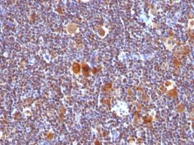 Immunohistochemistry-Paraffin: Bax Antibody (SPM336) - Azide and BSA Free [NBP2-34763] - Formalin-fixed, paraffin-embedded human Hodgkin's Lymphoma stained with Bax Antibody (SPM336).