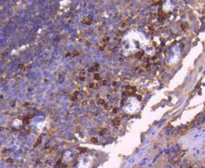 Immunohistochemistry-Paraffin: Bax Antibody (SZ3-07) [NBP2-67365] - Analysis of paraffin-embedded human tonsil tissue using anti-Bax antibody. Counter stained with hematoxylin.
