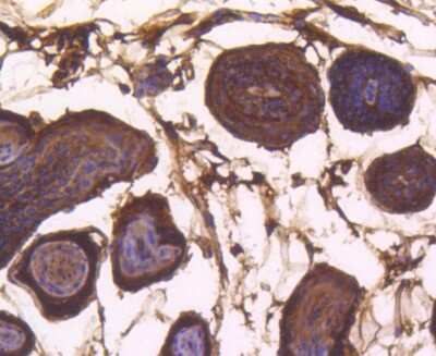 Immunohistochemistry-Paraffin: Bax Antibody (SZ3-07) [NBP2-67365] - Analysis of paraffin-embedded mouse skin tissue using anti-Bax antibody. Counter stained with hematoxylin.