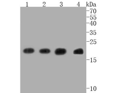 Western Blot: Bax Antibody (SZ3-07) [NBP2-67365] - Western blot analysis of Bax on different lysates. Proteins were transferred to a PVDF membrane and blocked with 5% BSA in PBS for 1 hour at room temperature. The primary antibody (1/500) was used in 5% BSA at room temperature for 2 hours. Goat Anti-Rabbi