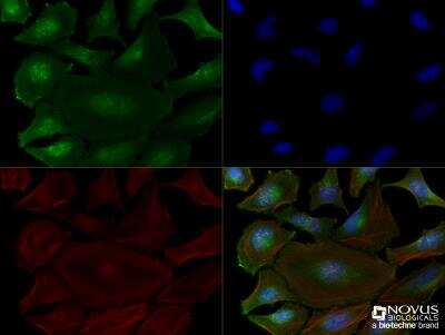 Immunocytochemistry/Immunofluorescence: Bax inhibitor 1 Antibody (20F248) [NBP2-24949] - HeLa cells were fixed for 10 minutes using 10% formalin and then permeabilized for 5 minutes using 1X TBS + 0.5% Triton-X100. The cells were incubated with anti Bax inhibitor 1 (20F248), NBP2-24949, at a 1:200 dilution overnight at 4C and detected with an anti-mouse IgM Dylight 488 (Green) at a 1:500 dilution. Actin was detected with Phalloidin 568 (Red) at a 1:200 dilution. Nuclei were counterstained with DAPI (Blue). Cells were imaged using a 40X objective.
