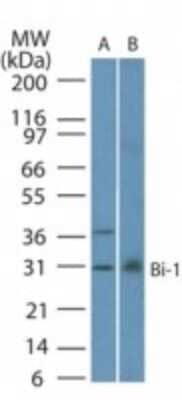 Western Blot: Bax inhibitor 1 Antibody (20F248) [NBP2-24949] - Analysis of Bi-1 in A) A549 and B) human lung lysate using this antibody at 1:1000.