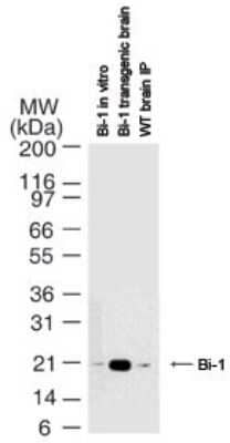 Western Blot: Bax inhibitor 1 Antibody (20F565) - Azide and BSA Free [NBP2-80591] - analysis of Bi-1 with this antibody. Lane 1: in vitro translated human Bi-1 protein. Lanes 2 and 3: IP/WB of Bi-1 protein enriched in the transgenic mouse brain (Lane 2) or wildtype brain (Lane 3). IP was done with a polyclonal Bi-1 antibody, followed by WB with this antibody. Image from the standard format of this antibody.