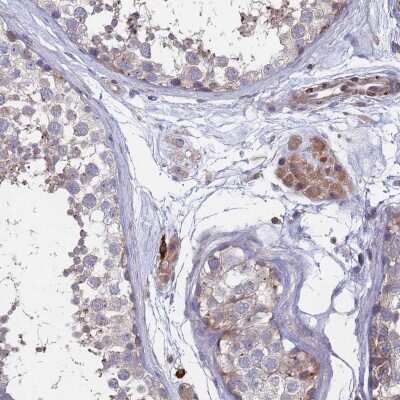 Immunohistochemistry-Paraffin Bax inhibitor 1 Antibody - BSA Free