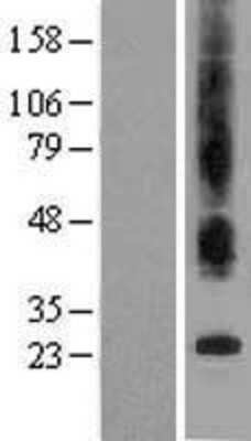 Western Blot: Bax inhibitor 1 Overexpression Lysate (Adult Normal) [NBL1-16807] Left-Empty vector transfected control cell lysate (HEK293 cell lysate); Right -Over-expression Lysate for Bax inhibitor 1.