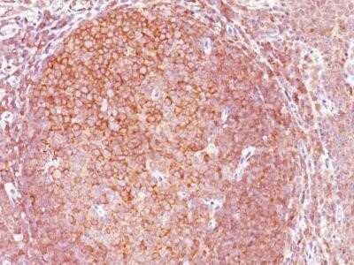 Immunohistochemistry-Paraffin: Bcl-10 Antibody (BL10/411) - Azide and BSA Free [NBP2-33190] - Formalin-paraffin human tonsil stained with Bcl-10 Ab (BL10/411).