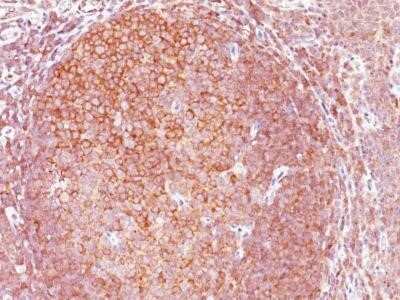 Immunohistochemistry-Paraffin: Bcl-10 Antibody (BL10/411) - IHC-Prediluted [NBP2-45152] - Formalin-paraffin human tonsil stained with Bcl-10 Ab (BL10/411).