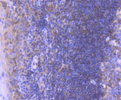 Immunohistochemistry-Paraffin: Bcl-10 Antibody (SN74-04) [NBP2-67714] - Analysis of paraffin-embedded human tonsil tissue using anti-Bcl10 antibody. Counter stained with hematoxylin.