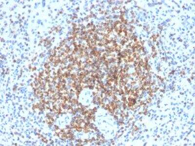 Immunohistochemistry-Paraffin: Bcl-2 Antibody (BCL2/2210R) - Azide and BSA Free [NBP2-75764] - FFPE human spleen stained with Bcl-2 Rabbit Recombinant Monoclonal Antibody (BCL2/2210R).