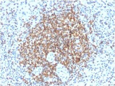 Immunohistochemistry-Paraffin: Bcl-2 Antibody (BCL2/2210R) [NBP2-75761] - Formalin-fixed, paraffin-embedded human spleen stained with Bcl-2 Rabbit Recombinant Monoclonal Antibody (BCL2/2210R).