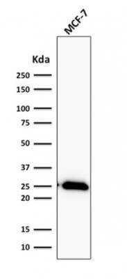 Western Blot: Bcl-2 Antibody (BCL2/2210R) [NBP2-75761] - Analysis of human MCF-7 cell lysate using Bcl-2 Rabbit Recombinant Monoclonal Antibody (BCL2/2210R).