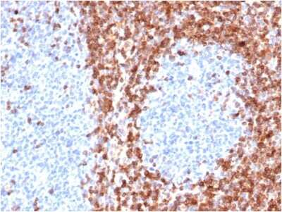 Immunohistochemistry-Paraffin: Bcl-2 Antibody (BCL2/6426R) [NBP3-07413] - Formalin-fixed, paraffin-embedded human tonsil stained with Bcl-2 Rabbit Recombinant Monoclonal Antibody (BCL2/6426R).