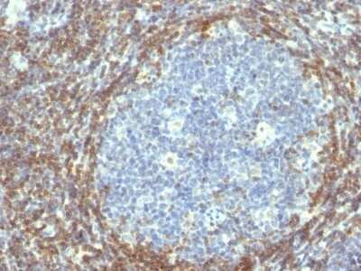 Immunohistochemistry-Paraffin: Bcl-2 Antibody (BCL2/782) [NBP2-44783] - Human Tonsil stained with Bcl-2 Monoclonal Antibody (BCL2/782).
