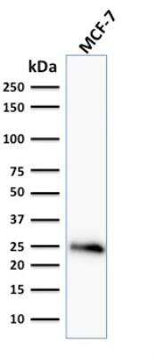 Western Blot: Bcl-2 Antibody (BCL2/796) - Azide and BSA Free [NBP2-47852] - MCF-7 cell lysate using Bcl-2 Mouse Monoclonal Antibody (BCL2/796).