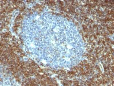 Immunohistochemistry-Paraffin: Bcl-2 Antibody (BCL2/796) [NBP2-44784] - Human Tonsil stained with Bcl-2 Monoclonal Antibody (BCL2/796).
