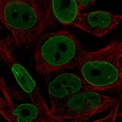 Immunocytochemistry/Immunofluorescence: Bcl-2 Antibody [NBP2-58567] - Staining of human cell line SK-MEL-30 shows localization to nucleoplasm & nuclear membrane.