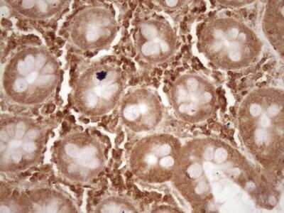 Immunohistochemistry: Bcl-2 Antibody (OTI9D3) - Azide and BSA Free [NBP2-70245] - Analysis of Human colon tissue. (Heat-induced epitope retrieval by 1 mM EDTA in 10mM Tris, pH8.5, 120C for 3min)