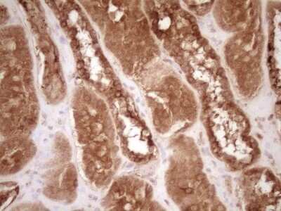 Immunohistochemistry: Bcl-2 Antibody (OTI9D3) - Azide and BSA Free [NBP2-70245] - Analysis of Human Kidney tissue. (Heat-induced epitope retrieval by 1 mM EDTA in 10mM Tris, pH8.5, 120C for 3min)