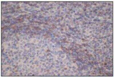 Immunohistochemistry-Paraffin: Bcl-2 Antibody (P21-A) [NBP1-79011] -  Formalin-fixed and paraffin-embedded human tonsil tissue (4 um) stained with anti - Bcl-2 antibody showsstrong membrane immunostaining of folicular cells.