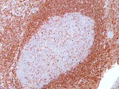 Immunohistochemistry-Paraffin: Bcl-2 Antibody (SPM117) [NBP2-34391] - Formalin-fixed, paraffin-embedded human tonsil stained with Bcl-2 Mouse Monoclonal Antibody (SPM117).