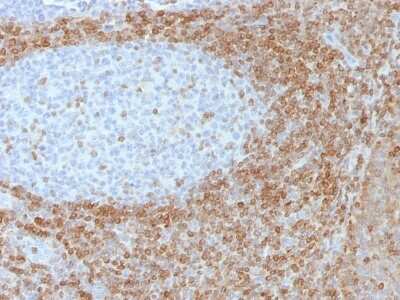 Immunohistochemistry-Paraffin: Bcl-2 Antibody (SPM530) - Azide and BSA Free [NBP2-34442] - Formalin-fixed, paraffin-embedded tonsil stained with Bcl-2 Mouse Monoclonal Antibody (SPM530).