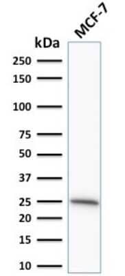 Western Blot: Bcl-2 Antibody (SPM530) [NBP2-34389] - Western Blot Analysis of human MCF-7 cell lysate using Bcl-2 Antibody (SPM530).