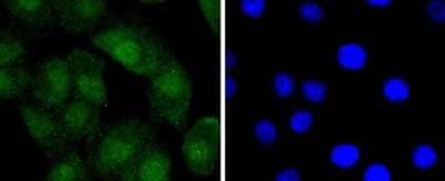 Immunocytochemistry/Immunofluorescence: Bcl-2 Antibody (SZ10-03) [NBP2-67351] - Staining Bcl-2 in A549 cells (green). The nuclear counter stain is DAPI (blue). Cells were fixed in paraformaldehyde, permeabilised with 0.25% Triton X100/PBS.