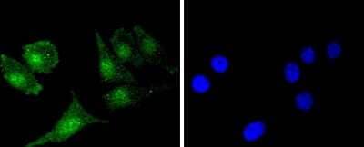 Immunocytochemistry/Immunofluorescence: Bcl-2 Antibody (SZ10-03) [NBP2-67351] - Staining Bcl-2 in SH-SY-5Y cells (green). The nuclear counter stain is DAPI (blue). Cells were fixed in paraformaldehyde, permeabilised with 0.25% Triton X100/PBS.