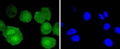 Immunocytochemistry/Immunofluorescence: Bcl-2 Antibody (SZ10-03) [NBP2-67351] - Staining Bcl-2 in MCF-7 cells (green). The nuclear counter stain is DAPI (blue). Cells were fixed in paraformaldehyde, permeabilised with 0.25% Triton X100/PBS.