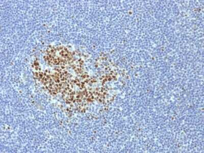 Immunohistochemistry-Paraffin: Bcl-6 Antibody (BCL6/1718) [NBP3-08865] - Formalin-fixed, paraffin-embedded human Tonsil stained with Bcl-6 Mouse Monoclonal Antibody (BCL6/1718).