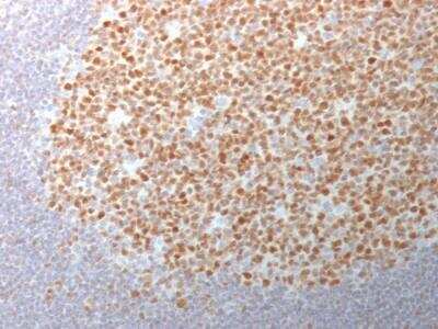 Immunohistochemistry-Paraffin: Bcl-6 Antibody (BCL6/1982) - Azide and BSA Free [NBP2-75749] - Formalin-fixed, paraffin-embedded human Tonsil stained with BCL-6 Mouse Monoclonal Antibody (BCL6/1982).