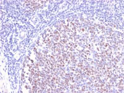 Immunohistochemistry-Paraffin: Bcl-6 Antibody (BCL6/2497R) - Azide and BSA Free [NBP3-08313] - Formalin-fixed, paraffin-embedded human Tonsil stained with Bcl-6 Rabbit Recombinant Monoclonal Antibody (BCL6/2497R).