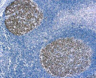 Immunohistochemistry-Paraffin: Bcl-6 Antibody (LN22) [NBP2-26501] - Formalin fixed paraffin embedded human tonsil stained with Bcl-6 antibody (NBP2-26501).