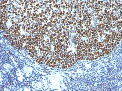 Immunohistochemistry-Paraffin: Bcl-6 Antibody (SPM602) - Azide and BSA Free [NBP3-08851] - Formalin-fixed, paraffin-embedded human Tonsil stained with Bcl-6 Monoclonal Antibody (SPM602).