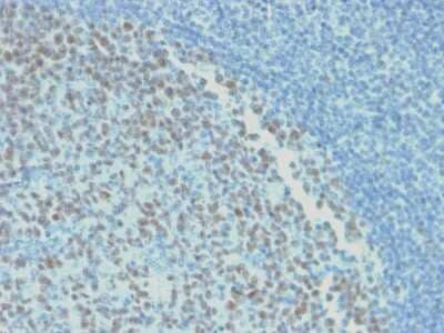 Immunohistochemistry-Paraffin: Bcl-6 Antibody (rBCL6/1718) - Azide and BSA Free [NBP3-08834] - Formalin-fixed, paraffin-embedded human Tonsil stained with Bcl-6 Mouse Recombinant Monoclonal Antibody (rBCL6/1718).