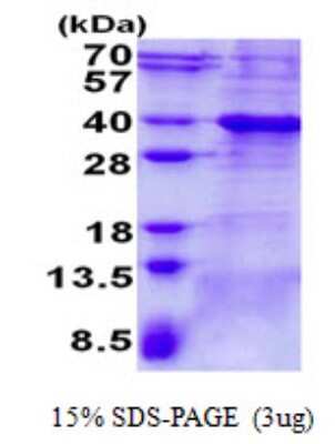 SDS-Page: Bcl 7A Protein [NBP2-22707]