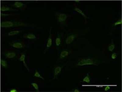 Immunocytochemistry/Immunofluorescence: Bcl-9 Antibody (1A2) [H00000607-M02] - Analysis of monoclonal antibody to BCL9 on HeLa cell . Antibody concentration 10 ug/ml.