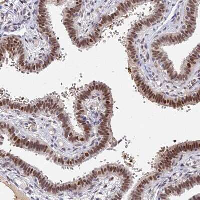 Immunohistochemistry-Paraffin Bcl-9 Antibody