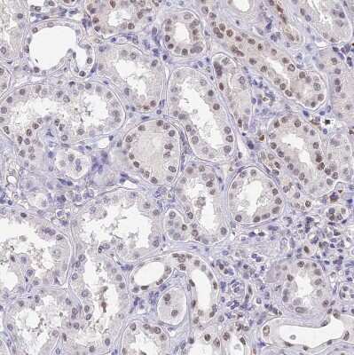 Immunohistochemistry-Paraffin Bcl-9 Antibody